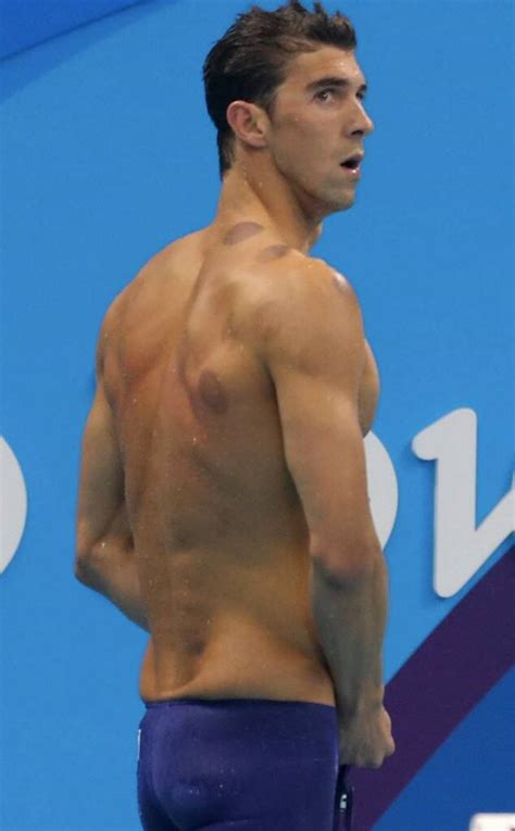 Michael Phelps And 7 More Stars Whove Tried Cupping E Online Ca