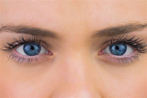 Ksantelazme Na Očima Su Jedan Od Simptoma Visokog Holesterola Ženars