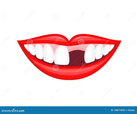 Human Mouth With Missing Tooth Stock Vector Illustration Of False