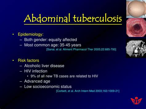 Ppt Management Of Abdominal Tuberculosis Joint Hospital Surgical