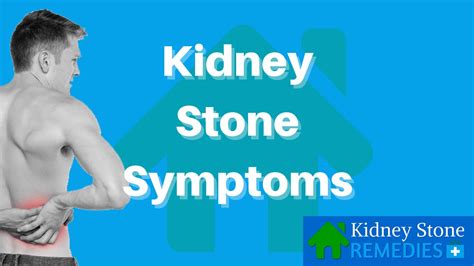 Kidney Stone Symptoms Kidney Stone Home Remedies Youtube
