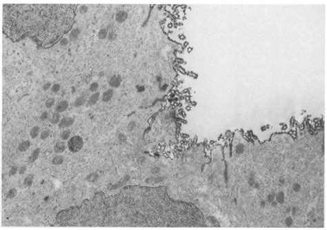 Electron Micrograph Of A Portion Of Two Adjacent Cells From A Serous
