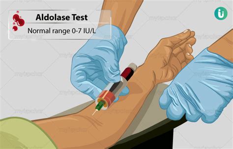 एल्डोलेज टेस्ट क्या है खर्च कब क्यों कैसे होता है aldolase test normal range price cost