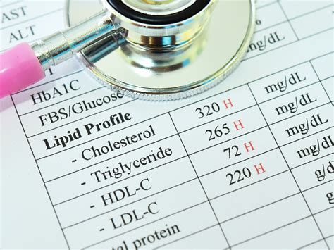 What they left out of the new cholesterol guidelines - Easy Health Options®