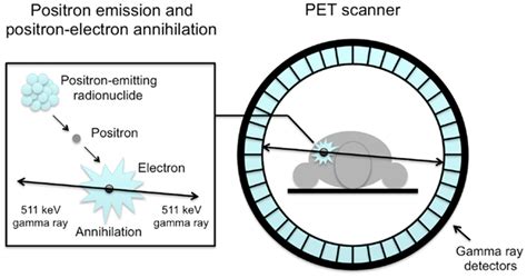 The Basics Of Positron Emission Tomography Pet