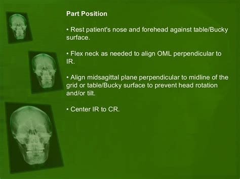 Positioning And Radiographic Anatomy Of The Skull Positivity
