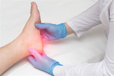 What Will A Podiatrist Do For Plantar Fasciitis Palmetto State Podiatry