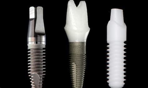 Implant Titanium Dental