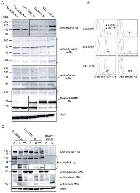 Ror1 Isoforms And Phosphorylation In Cll Patients Representative