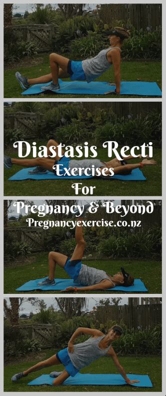 Diastasis recti can happen to any woman. Diastasis Recti -'Tummy Safe' Pre and Postnatal Core ...