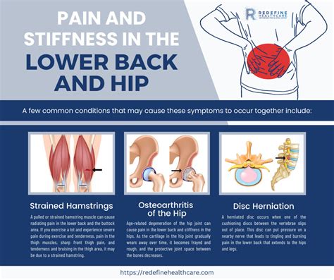 Why Does My Lower Back And Hip Hurt Njs Top Orthopedic Spine And Pain