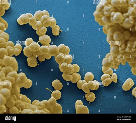 Las Bacterias De La Meningitis Color Análisis Micrografía De