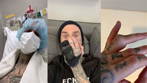 blink 182 cancela su gira por latinoamérica debido a una lesión de su baterista travis barker