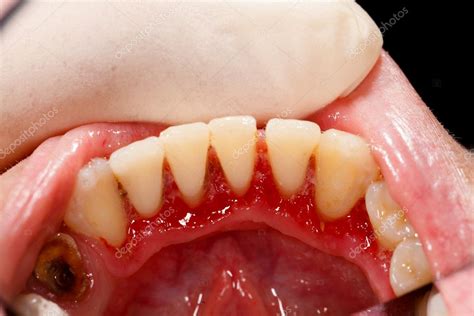Dentista Examinando Boca Enferma Fotografía De Stock © Lighthunter 24408361 Depositphotos