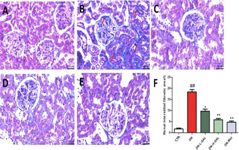 Sal Inhibits Renal Interstitial Fibrosis In Dn Rats Renal Interstitial