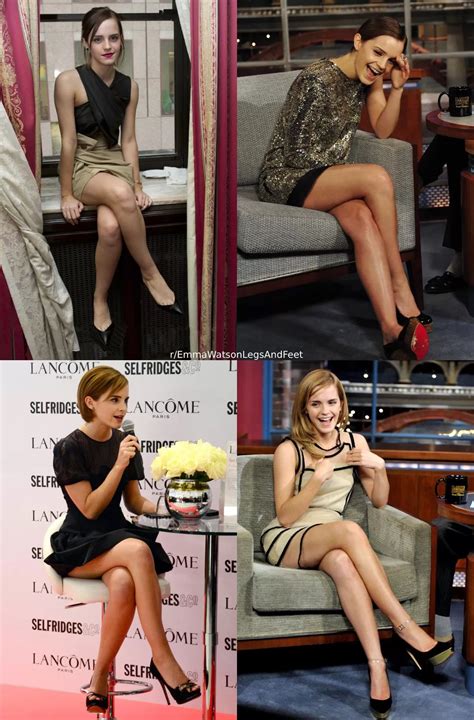 Once Emma Watson Starts Flaunting Her Legs I Know It S Game Over