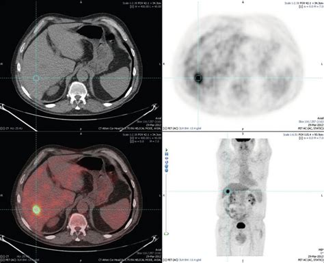 Colorectal Liver Metastases Clinical Gate