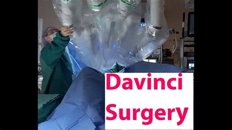 Da Vinci Robotic Hysterectomy YouTube