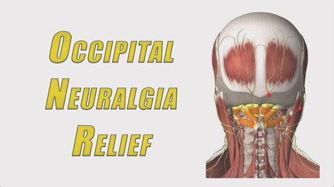Home Treatment For Occipital Neuralgia 5 Excellent Movements To