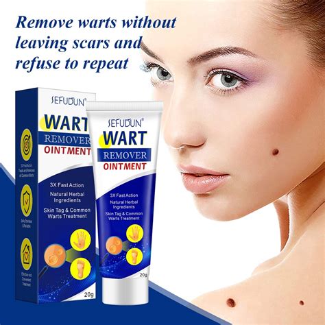 sefudun wart remover original cream wart removal ointment warts and skin tags remover 20g