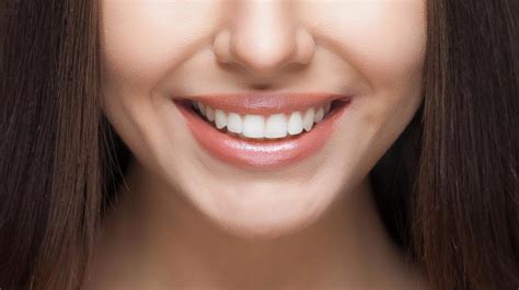 5 Ways To Have A Perfect Smile Vista Dental Care