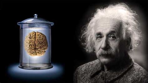 Einstein reportedly was slow in learning how to talk. Albert Einstein's Brain | Angie's Diary