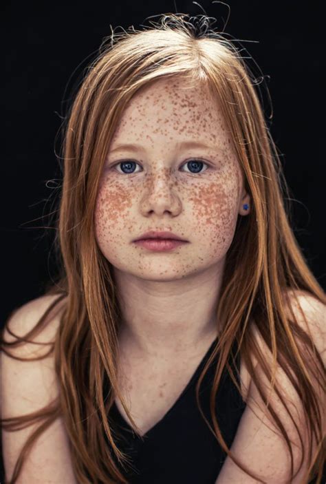 taches de rousseur freckles girl red freckles redheads