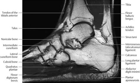 Foot Anatomy Mri Radiology