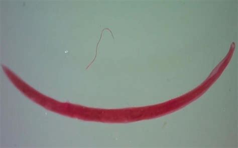 Ancylostoma Caninum Dog Hookworm Female Wm Microscope Slide