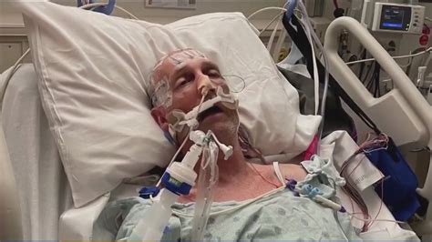 Medical Marvel Houston Man Survives Same Head Trauma Bob Saget Died Of