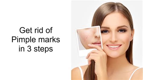 How To Remove Pimple Marks For Beginner Youtube