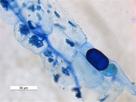 más de 5 ejemplos de hongos micorrízicos hechos detallados