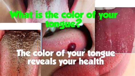 What Is The Color Of Your Tongue The Color Of Your Tongue Reveals Something About Your Health