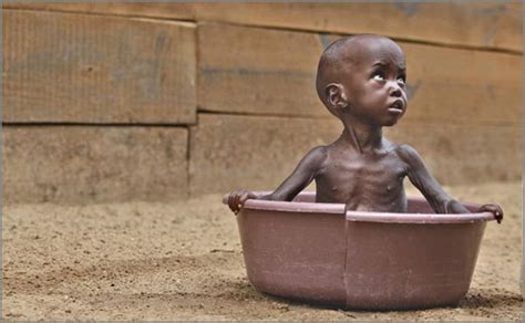 These 10 Countries Starving To Death Will Make You Think