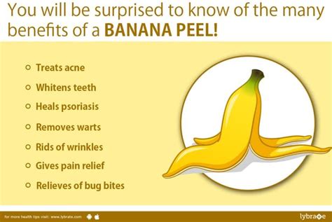 You Will Be Surprised To Know Of The Many Benefits Of A Banana Peel Banana Benefits Banana