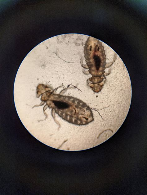 Microscopic View Of Chicken Body Lice Menacanthus Stramineus 100x