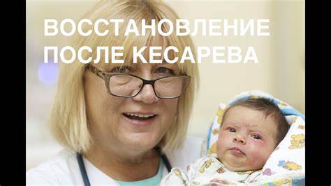 Как можно после кесарева убрать живот