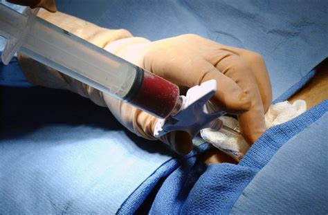 Bone Marrow Transplant Importance And Working Longevity