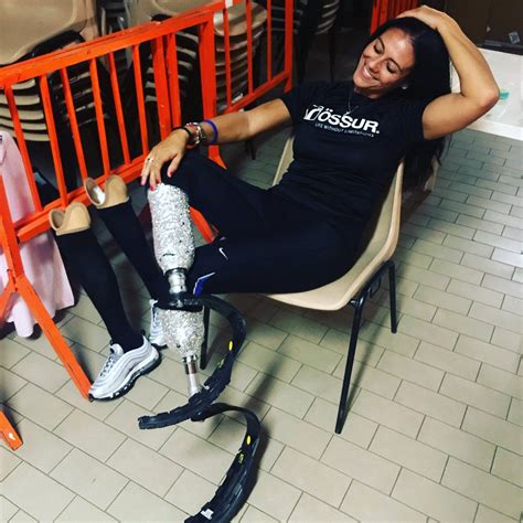 Amputee Lady Crystal Kingdom Prosthetic Leg Bionic Woman Health