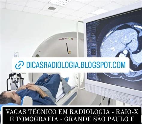 DICAS DE RADIOLOGIA Tudo Sobre Radiologia VAGA TÉCNICO EM RADIOLOGIA RAIO X E TOMOGRAFIA