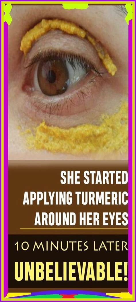 She Started Applying Turmeric Around Her Eyes Minutes Later Unbeli
