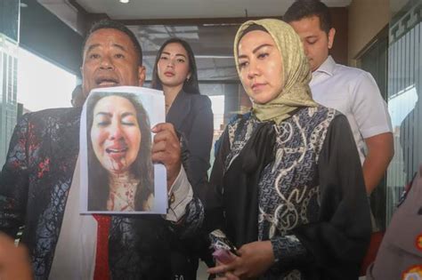 Venna Melinda Ungkap Ferry Irawan Lakukan Kdrt Bulan Terakhir Kaltim Post
