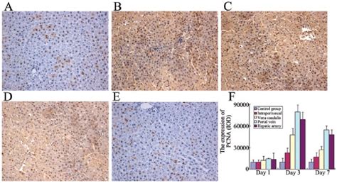 Expression Of Proliferating Cell Nuclear Antigen Pcna In Liver Tissue Download Scientific