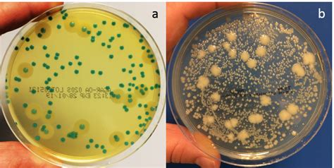 Selectivity And Differentiation In One Place Solus Listeria Oa Agar