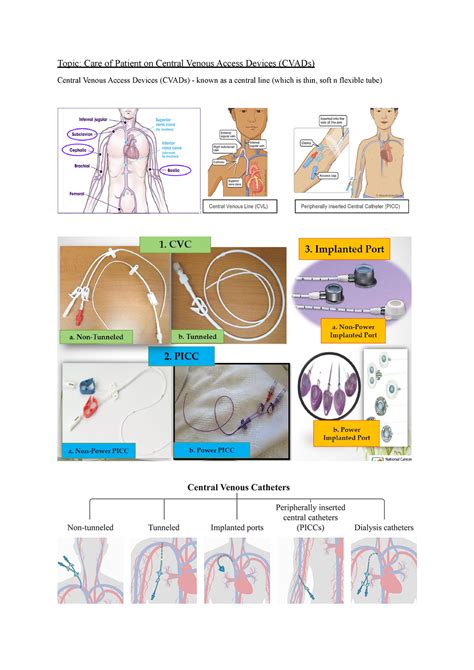 Central Venous Access Devices Cvads Central Venous Catheter Cvc A