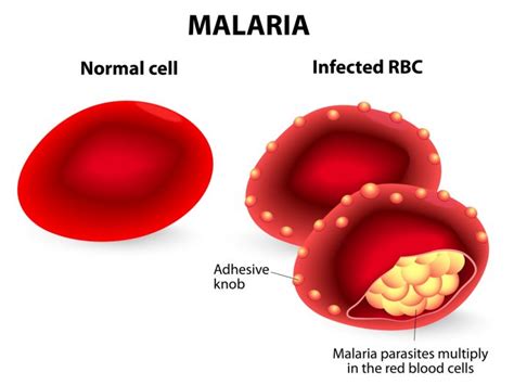 11 Efficient Natural Remedies For Malaria Organic Facts