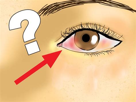 8 Things Your Eyes Are Trying To Tell You About Your Health Bewellhub