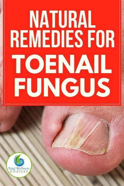 Find Out How To Get Rid Of Toenail Fungus With Natural Remedies