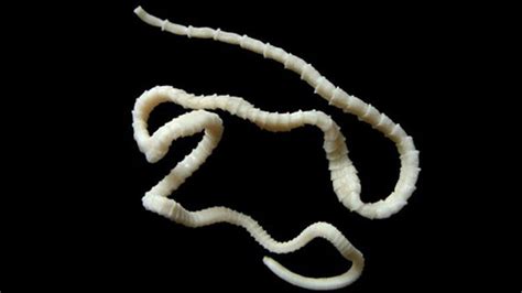 Mammoth 6ft Live Tapeworm Removed From Mans Gut Through His Mouth