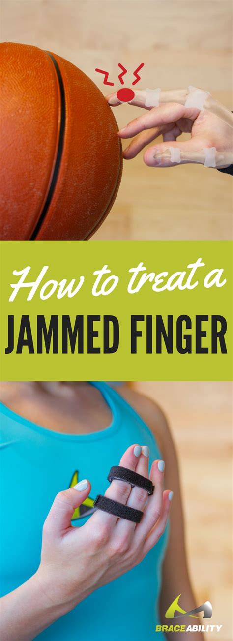 How To Treat A Sprained Thumb Unugtp